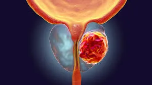 prostata