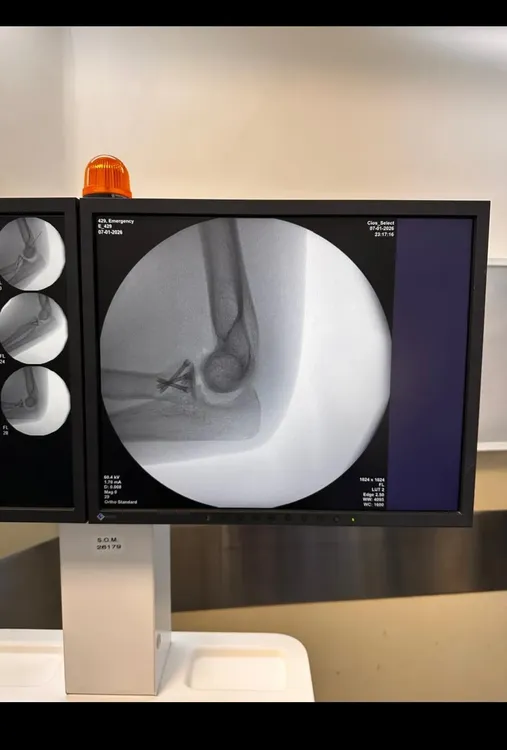 Screenshot_20260110_084822_Photos CLAVOS CODO